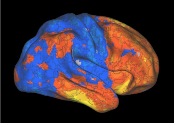 Hot colors indicate less efficient brain regions