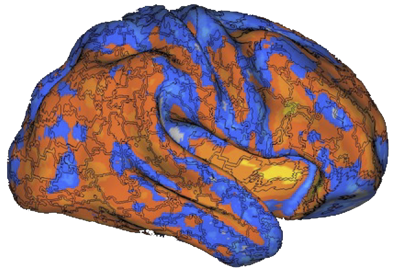 Hot colors indicate less efficient brain regions